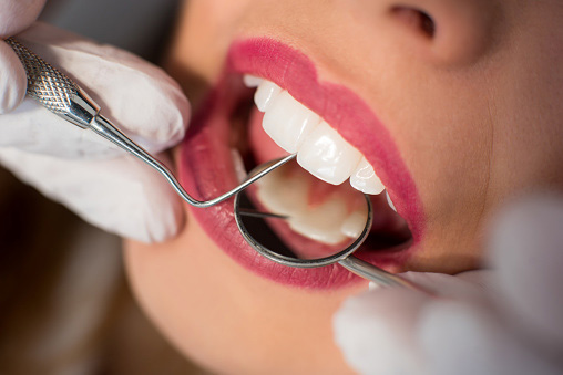 A woman getting her teeth cleaned at Cambridgeside Dental Associates in Cambridge, MA