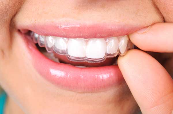 Woman using Invisalign clear aligner at Cambridgeside Dental Associates in Cambridge, MA